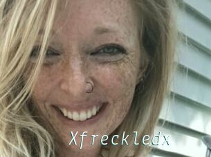 Xfreckledx